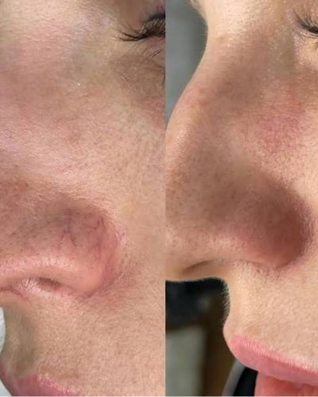 Элла. Студия перманентного макияжа, косметологии и массажа SYMMETRY в Москве, м. Киевская