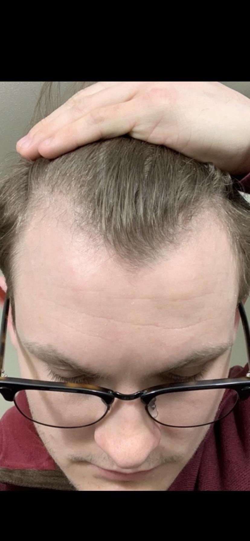 THE CACTUS EFFECT 10/10