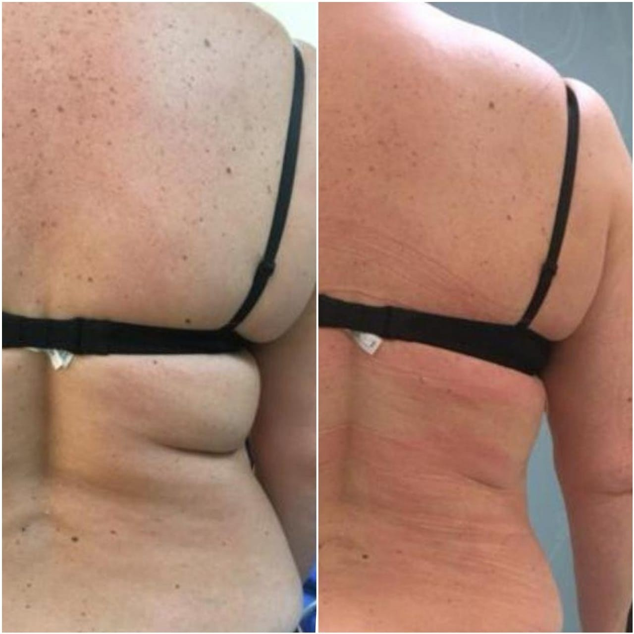 Косметолог Калининград Марина Швед