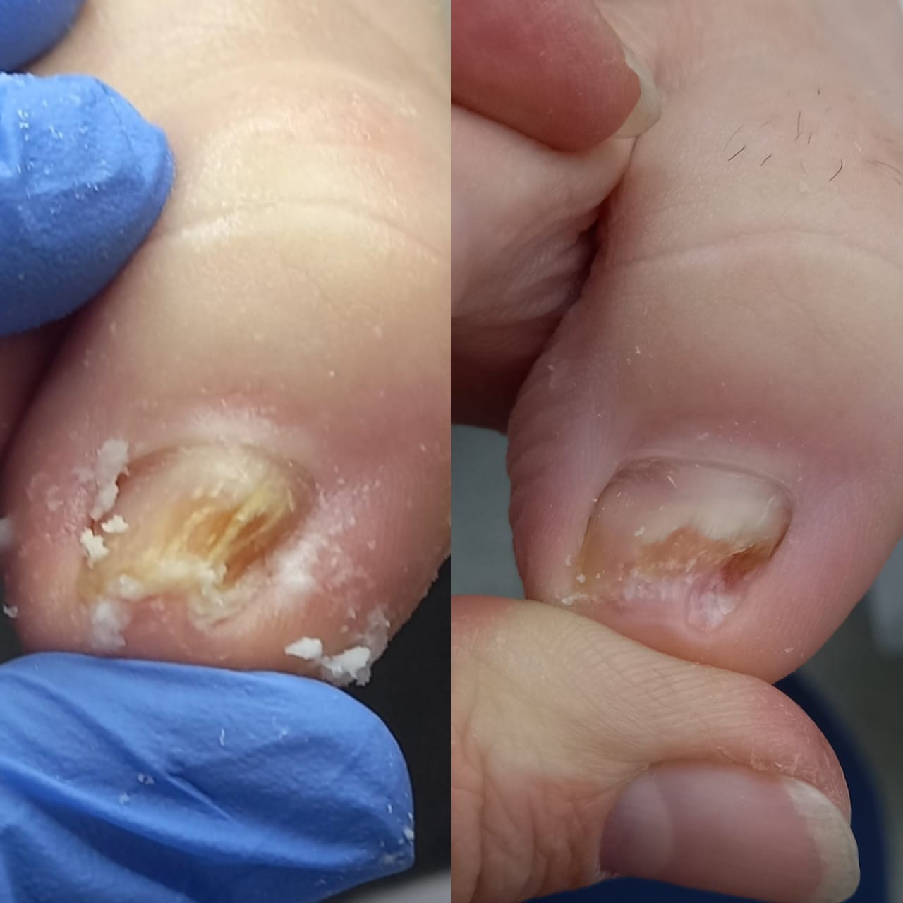 Коррекционная система ORA. Подолог г. Хабаровск — центр здоровой стопы «FOOTTIME»