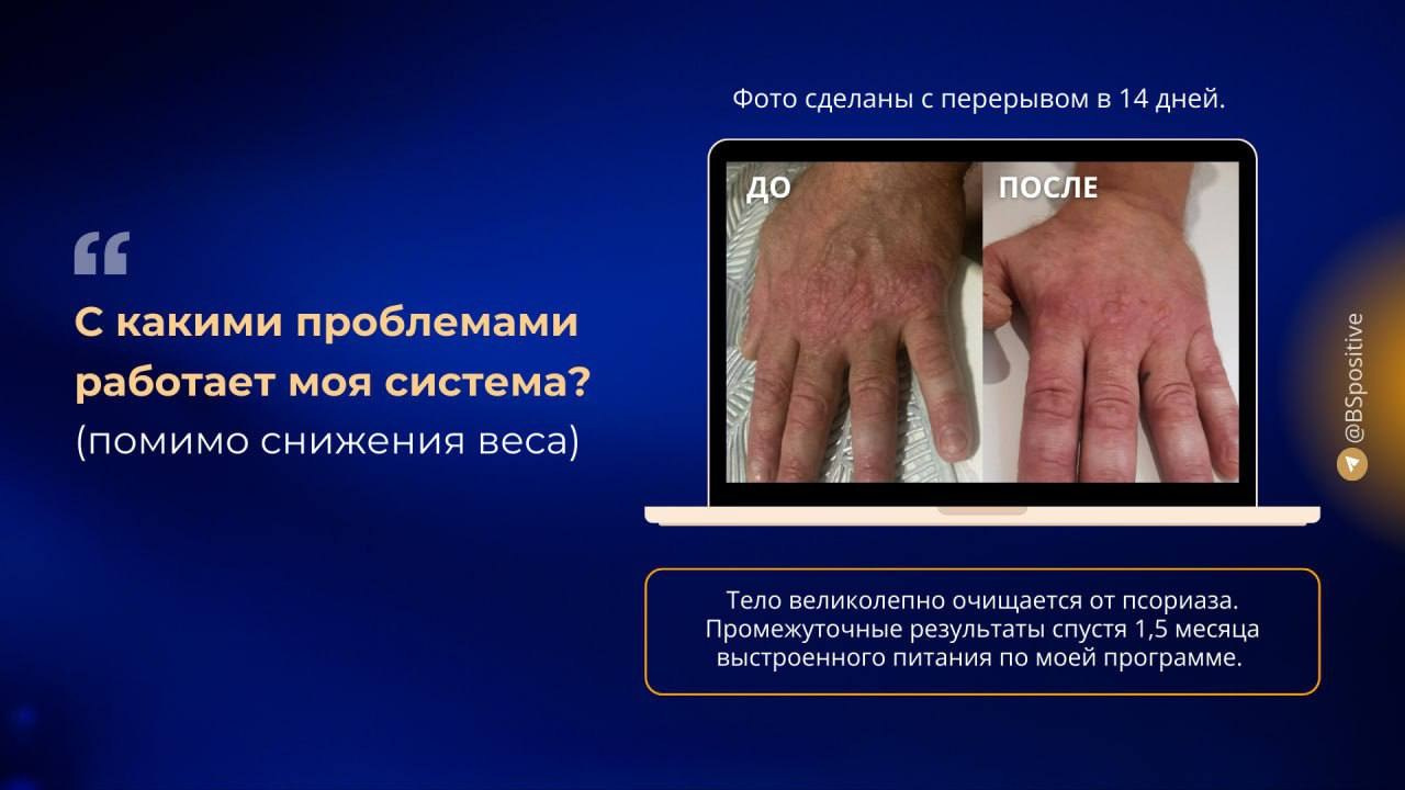 Программа «Стройность и здоровье». Светлана Бабаева, коуч-нутрициолог