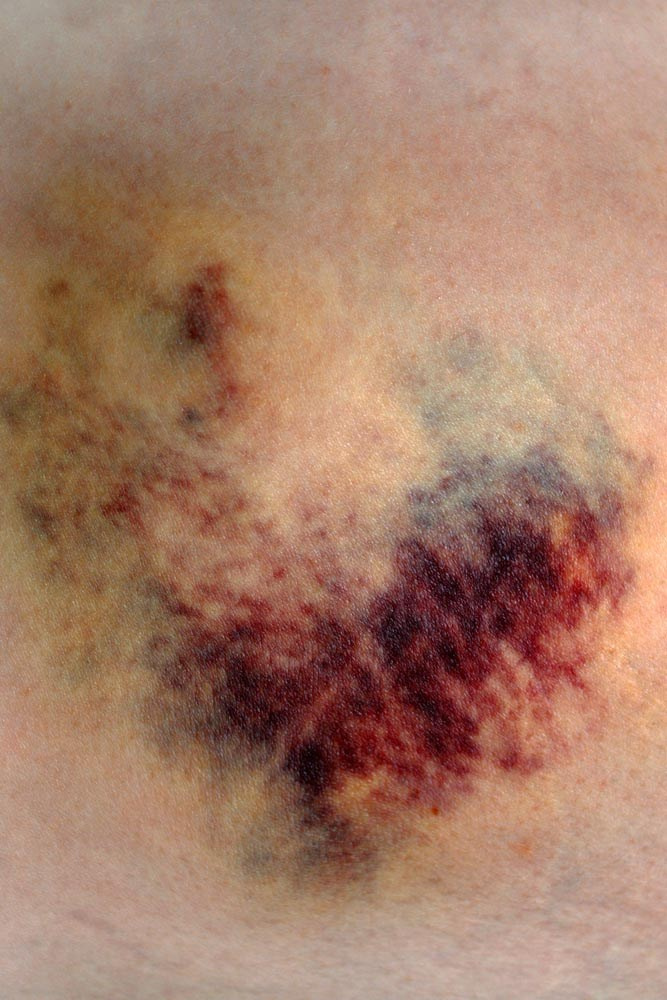 Книга «Dear parents, please send me bacon and Pervitin» художницы Уши Гроос. Private image