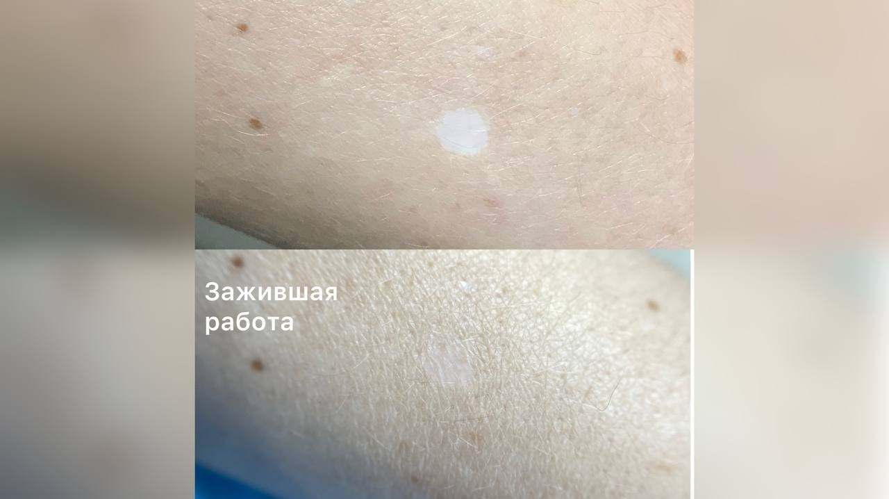 Элла. Студия перманентного макияжа, косметологии и массажа SYMMETRY в Москве, м. Киевская