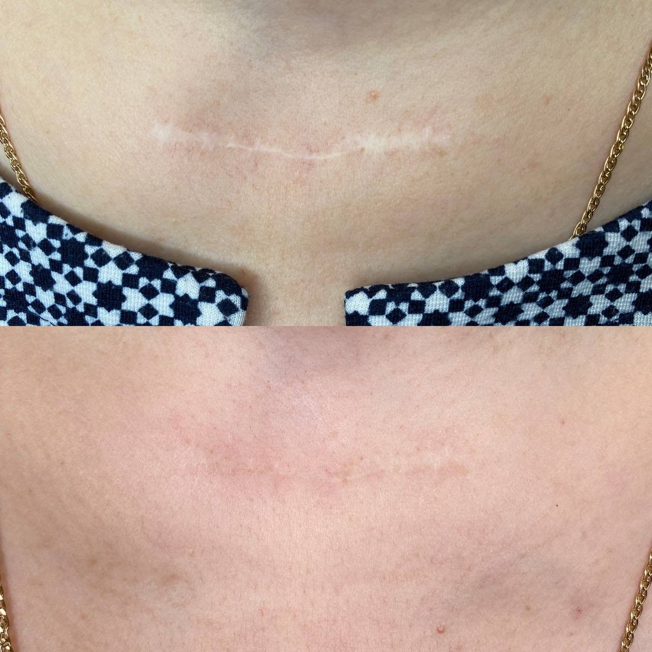 Элла. Студия перманентного макияжа, косметологии и массажа SYMMETRY в Москве, м. Киевская