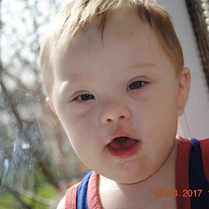 🌞 21.03 — МЕЖДУНАРОДНЫЙ ДЕНЬ ЧЕЛОВЕКА С СИНДРОМОМ ДАУНА: ЗНАКОМЬТЕСЬ, САША! 🌞