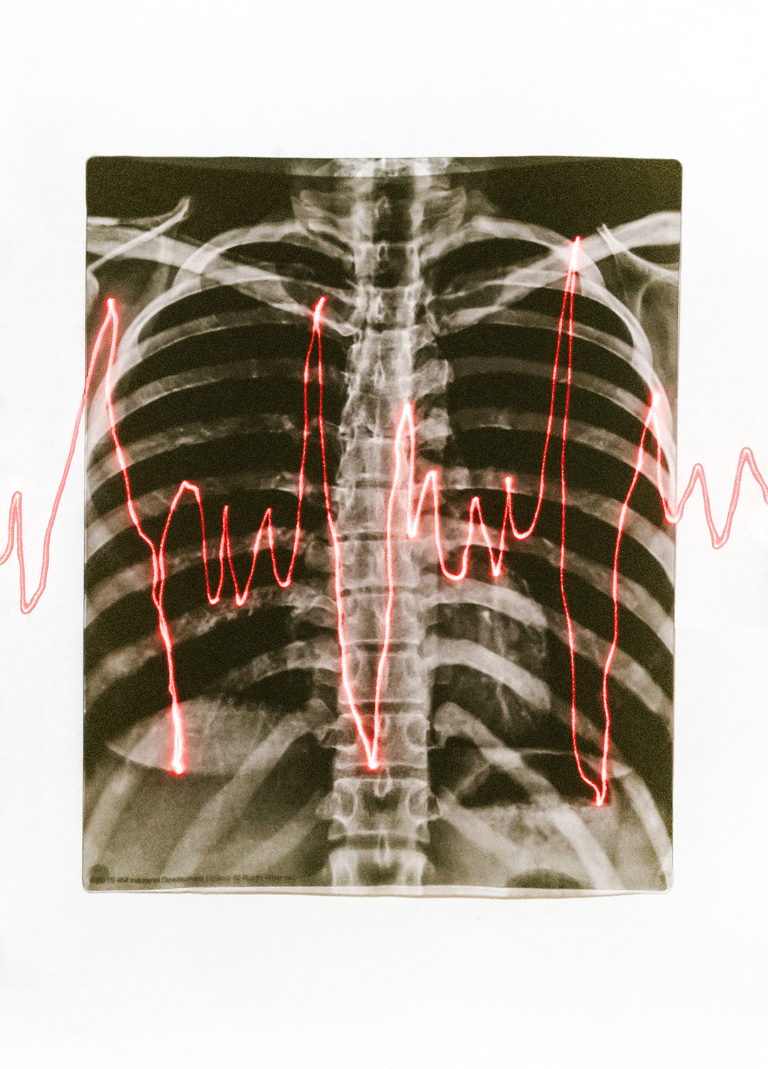 Выставка ''There are no miracles to come'' с 11 января по 11 февраля 2