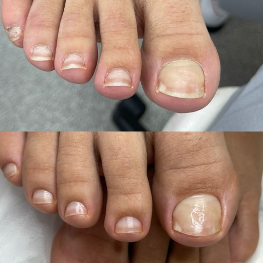 Гигиенический педикюр. Подолог г. Хабаровск — центр здоровой стопы «FOOTTIME»