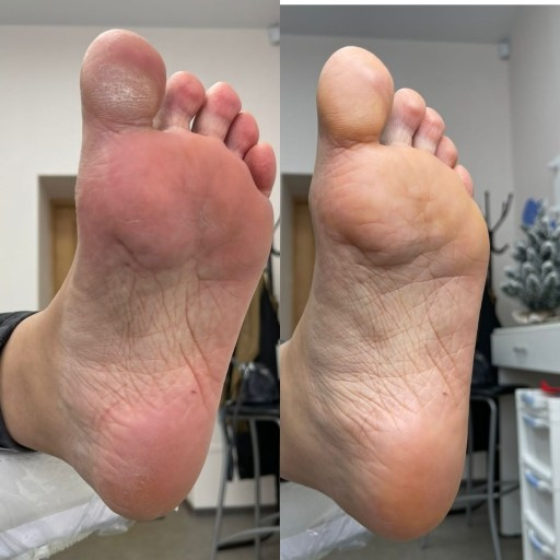 Гигиенический педикюр. Подолог г. Хабаровск — центр здоровой стопы «FOOTTIME»