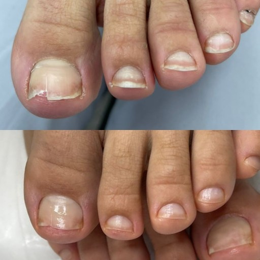 Гигиенический педикюр. Подолог г. Хабаровск — центр здоровой стопы «FOOTTIME»