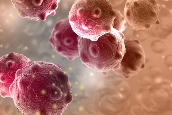 Женские заболевания: Вирус папилломы, миома, мастопатия, кисты, эндометриоз, менопауза, климакс. «Сово-Сова» продукция для омоложения, здоровья и долголетия