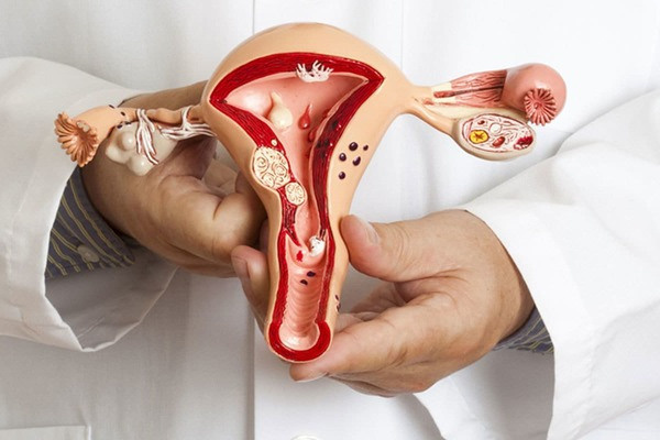 Женские заболевания: Вирус папилломы, миома, мастопатия, кисты, эндометриоз, менопауза, климакс. «Сово-Сова» продукция для омоложения, здоровья и долголетия