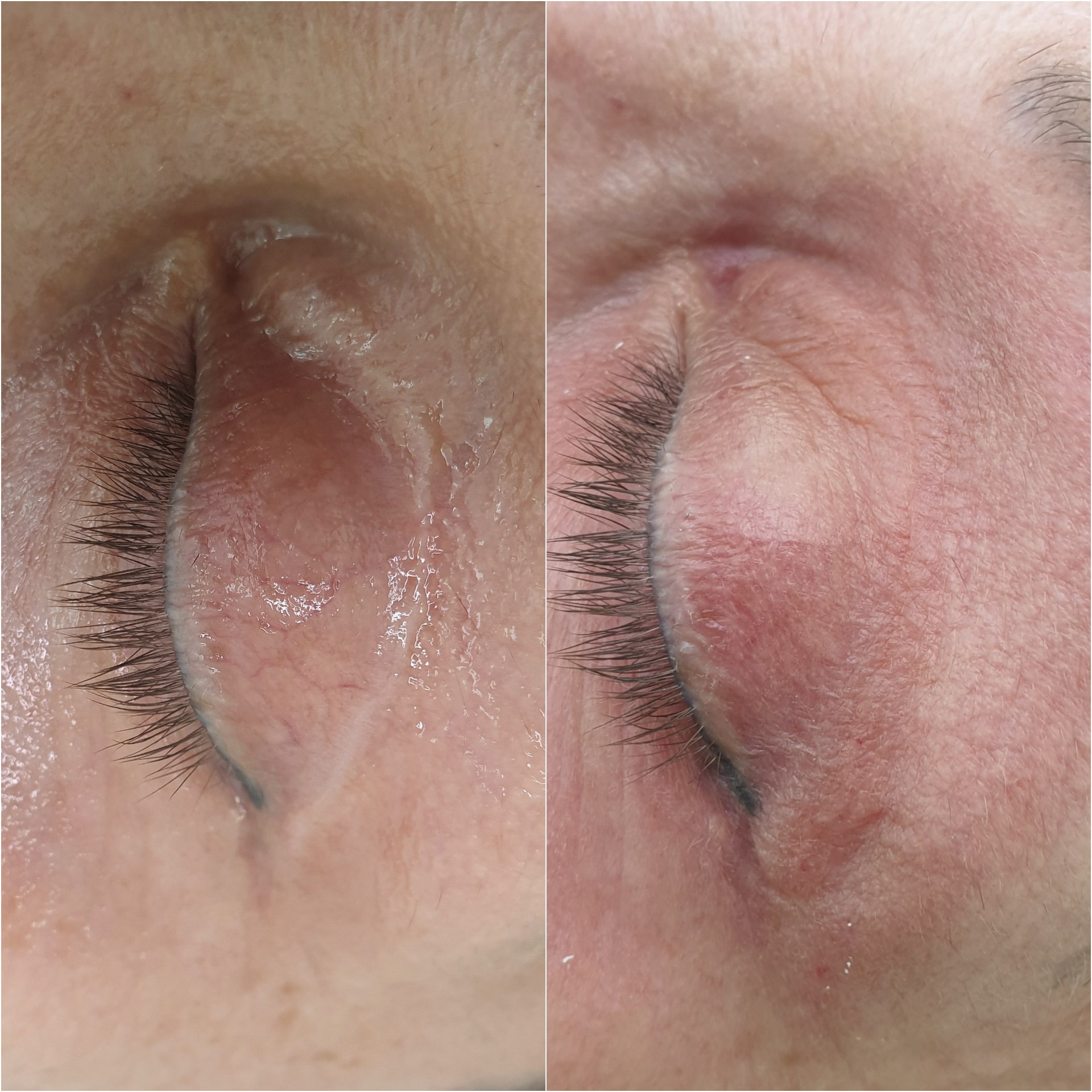 Элла. Студия перманентного макияжа, косметологии и массажа SYMMETRY в Москве, м. Киевская