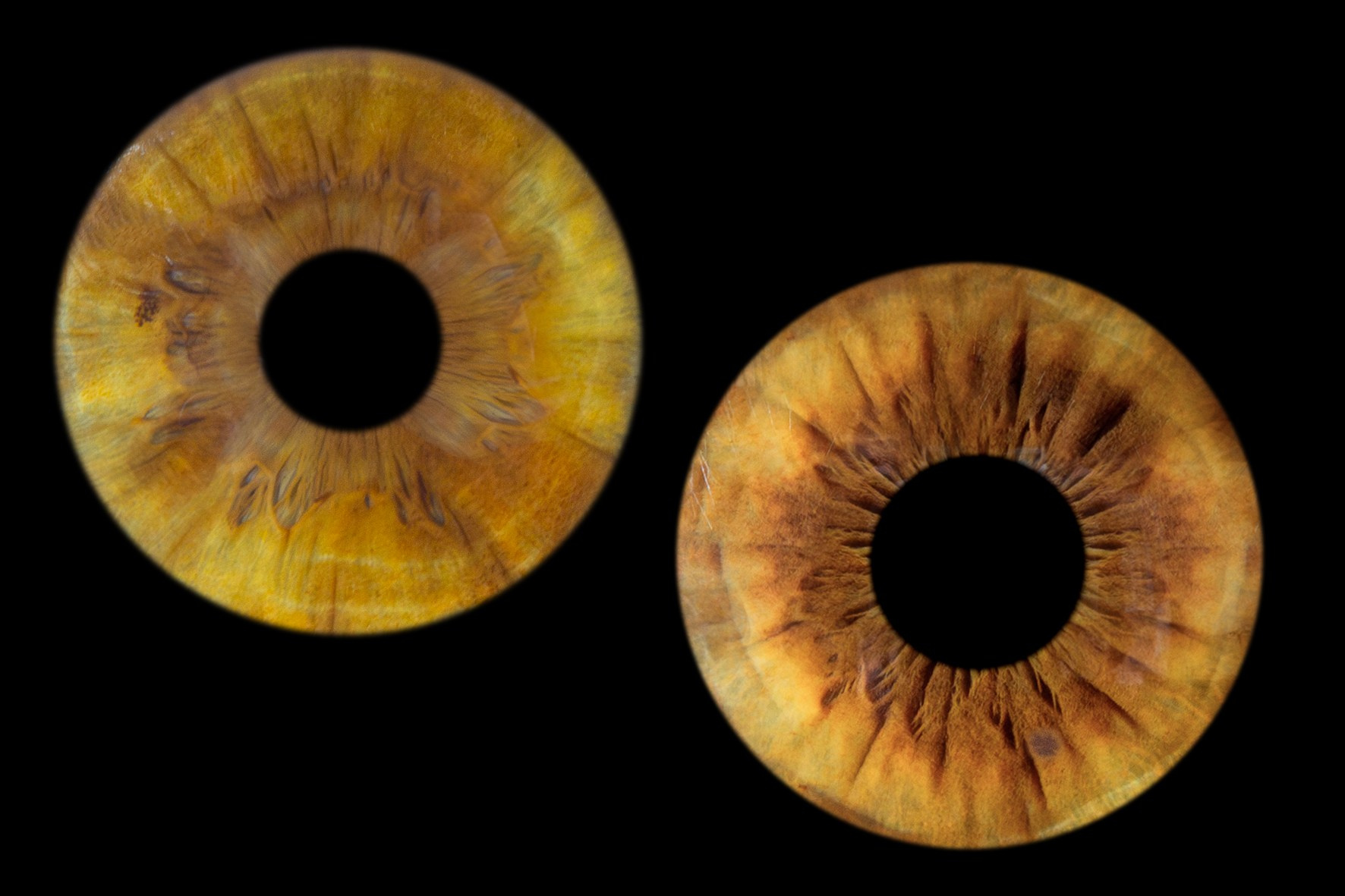 Фото радужки глаза LOOK IN