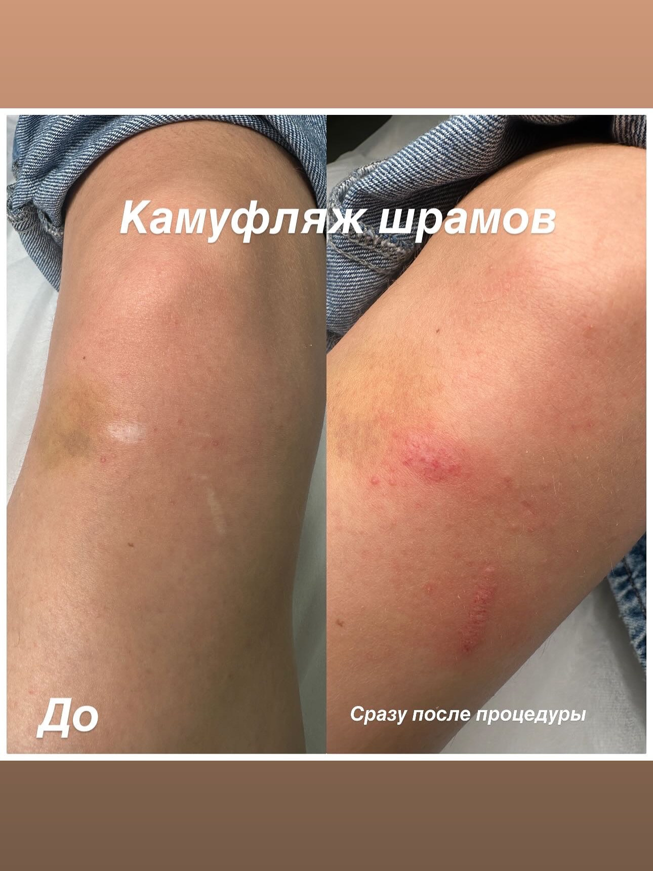 Элла. Студия перманентного макияжа, косметологии и массажа SYMMETRY в Москве, м. Киевская