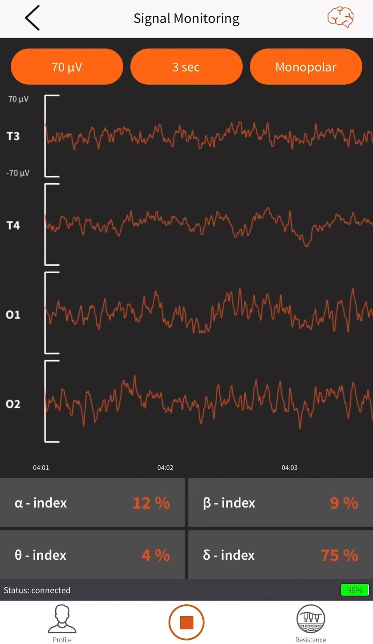 Symbols. ХРОНИКИ ХРОНОСА