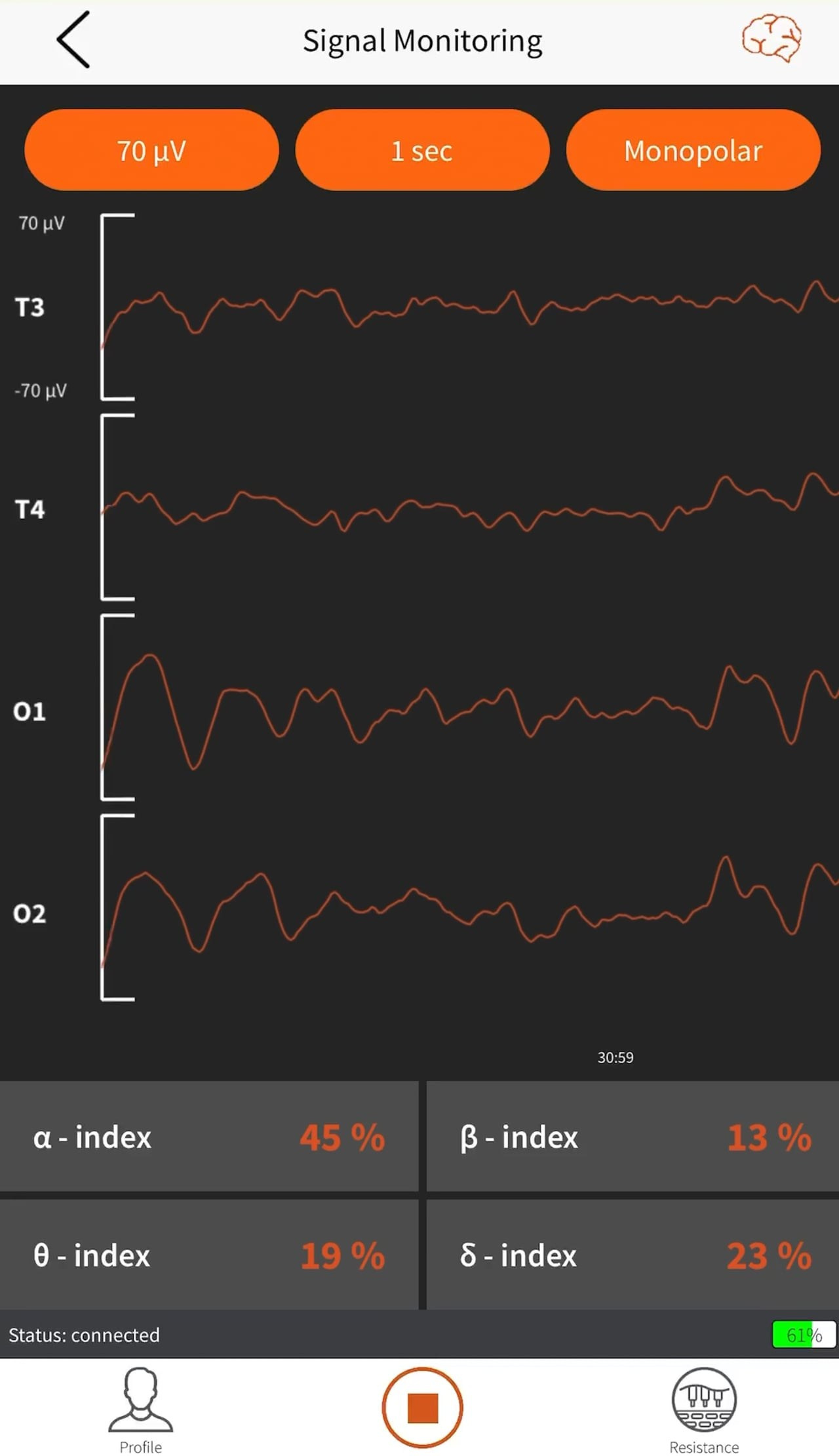 Symbols. ХРОНИКИ ХРОНОСА