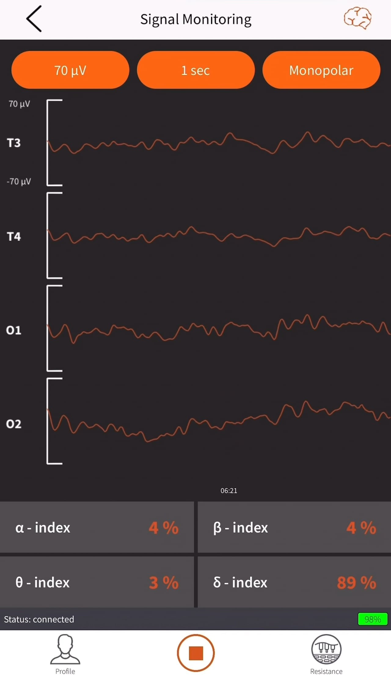 Symbols. ХРОНИКИ ХРОНОСА