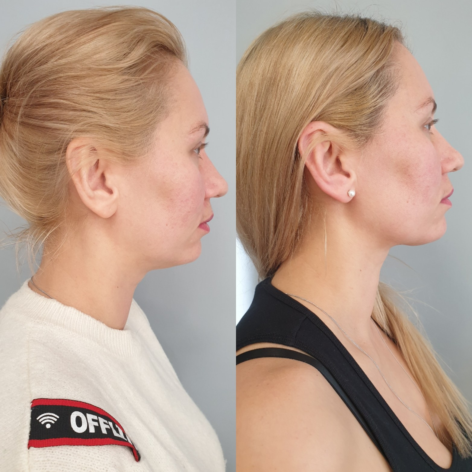 Косметолог Калининград Марина Швед