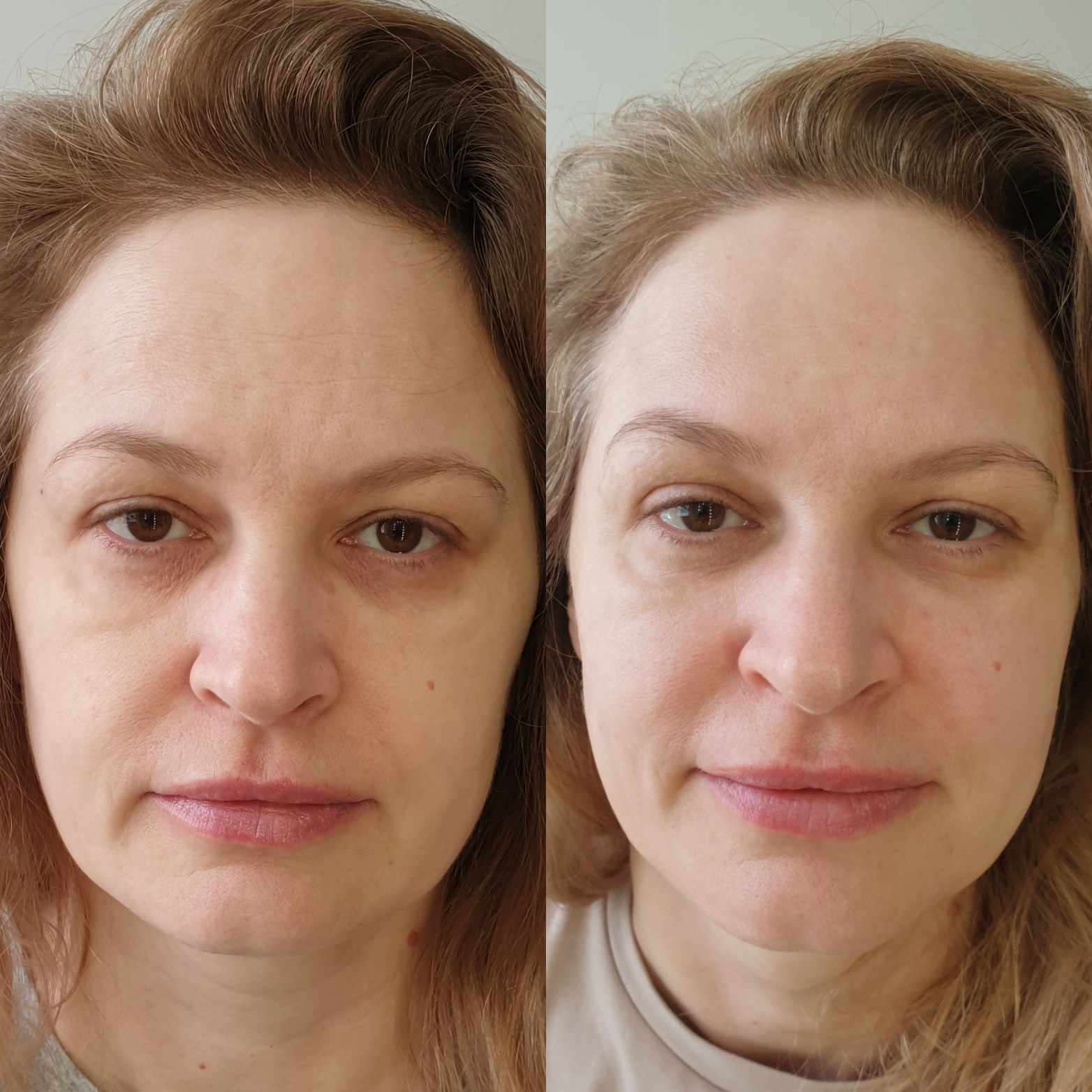 Косметолог Калининград Марина Швед