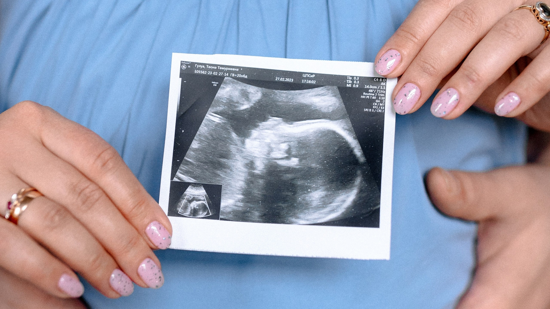 Советы от фотографа перед съемкой. Шашкова Вероника. Шашкова Вероника / Свадебный и семейный фотограф Москва и Ярославль