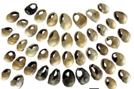 Бусы могут быть не только на шее, но и внутри нее. РЕНТГЕН КТ МРТ в Санкт-Петербурге Александра Лоншакова