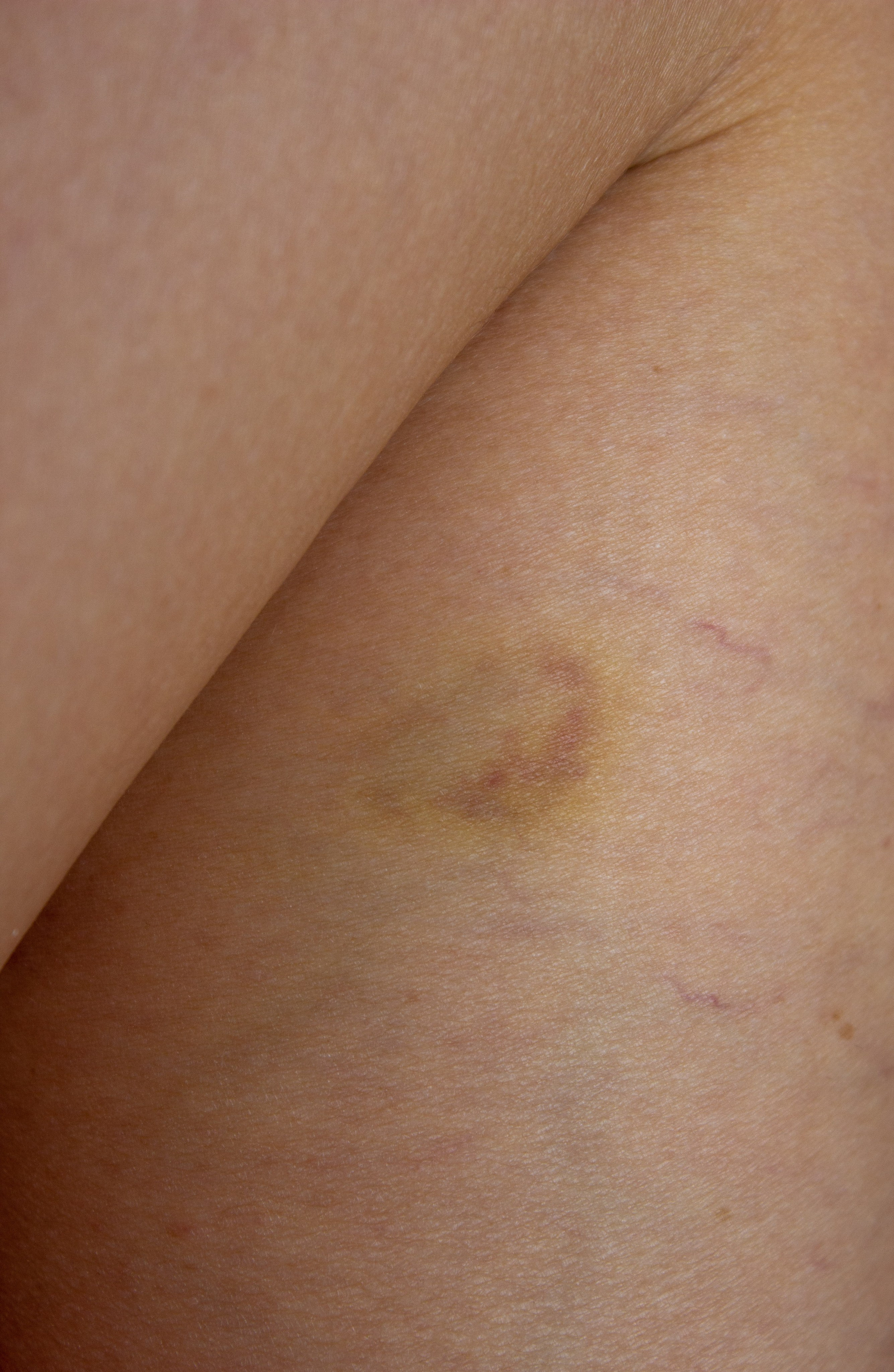 Анатомия трещин (красненькая биеннале, санкт-петербург, 2025). Julia Gorbunova