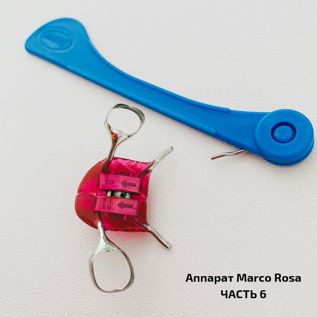 Блог врача. Стоматология «Ортодонт-Эстетик». Установка брекетов в Оренбурге, взрос