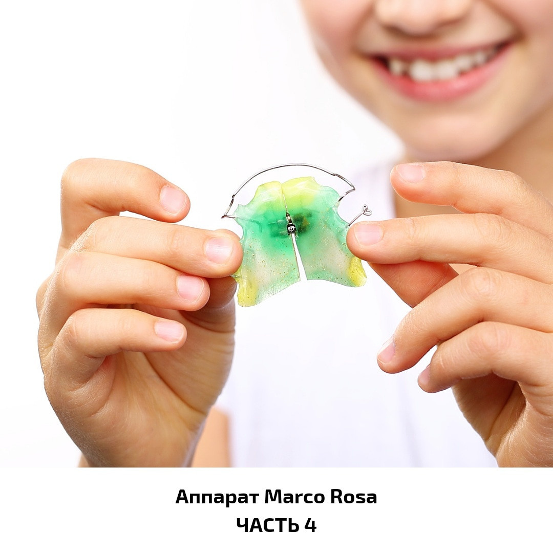 Блог врача. Стоматология «Ортодонт-Эстетик». Установка брекетов в Оренбурге, взрос