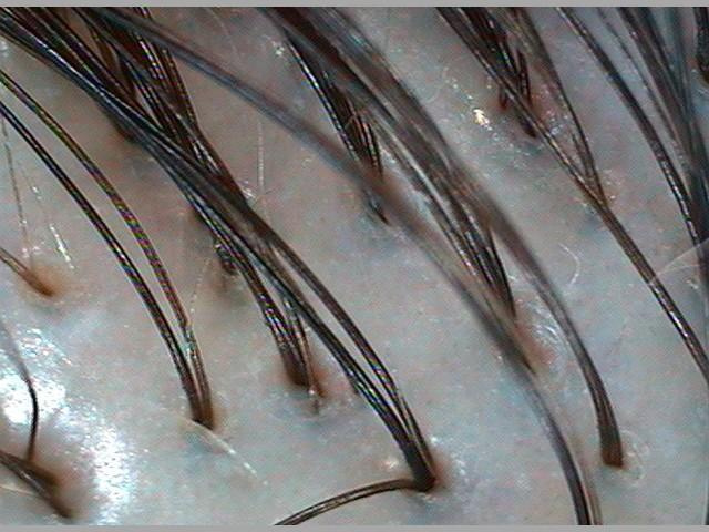 Восстановление волос и кожи головы от 500 р. Пилинг кожи головы, от м. Парикмахер-стилист-колорист Соколова Ольга г. Дзержинск