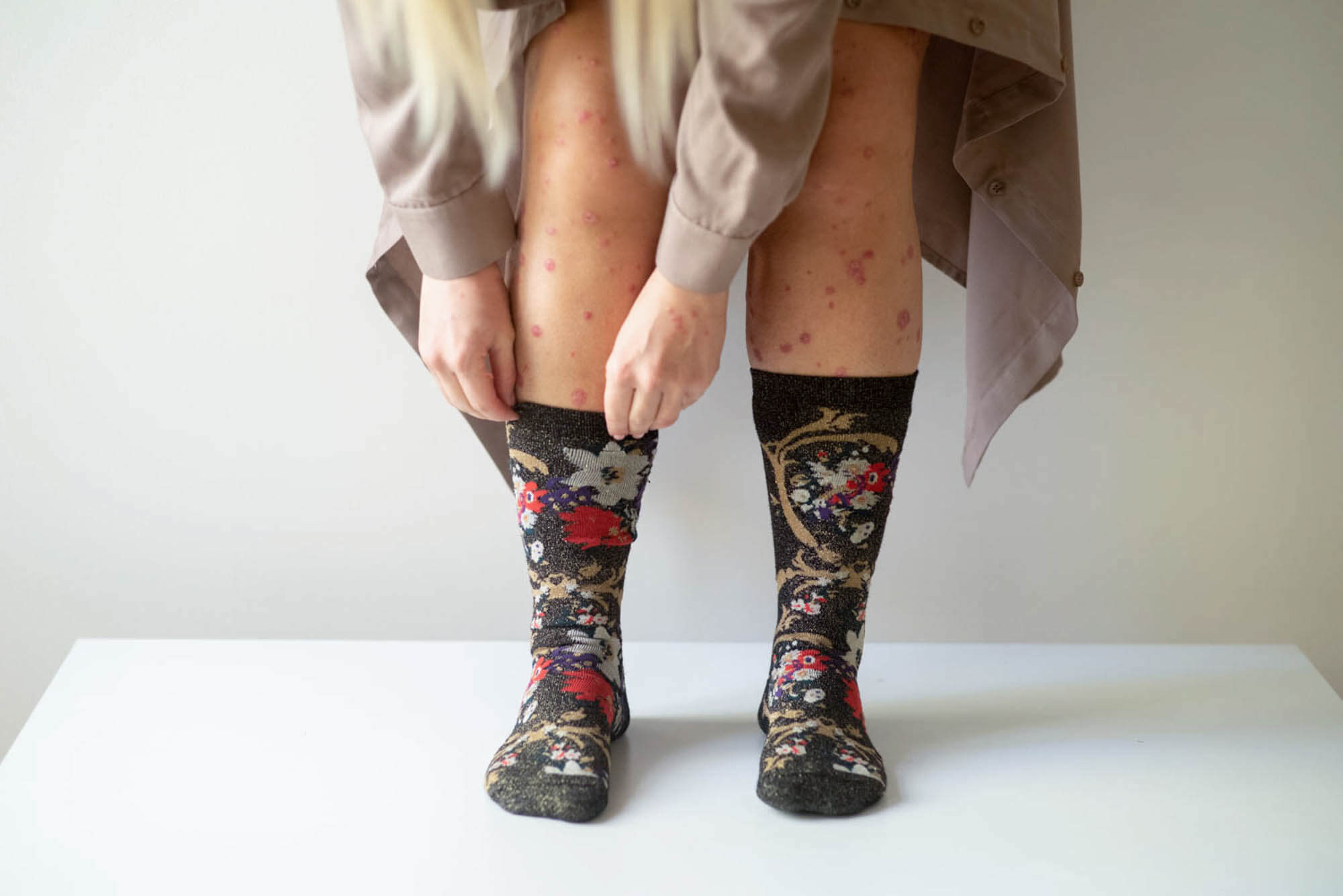 портрет тела в псориаз