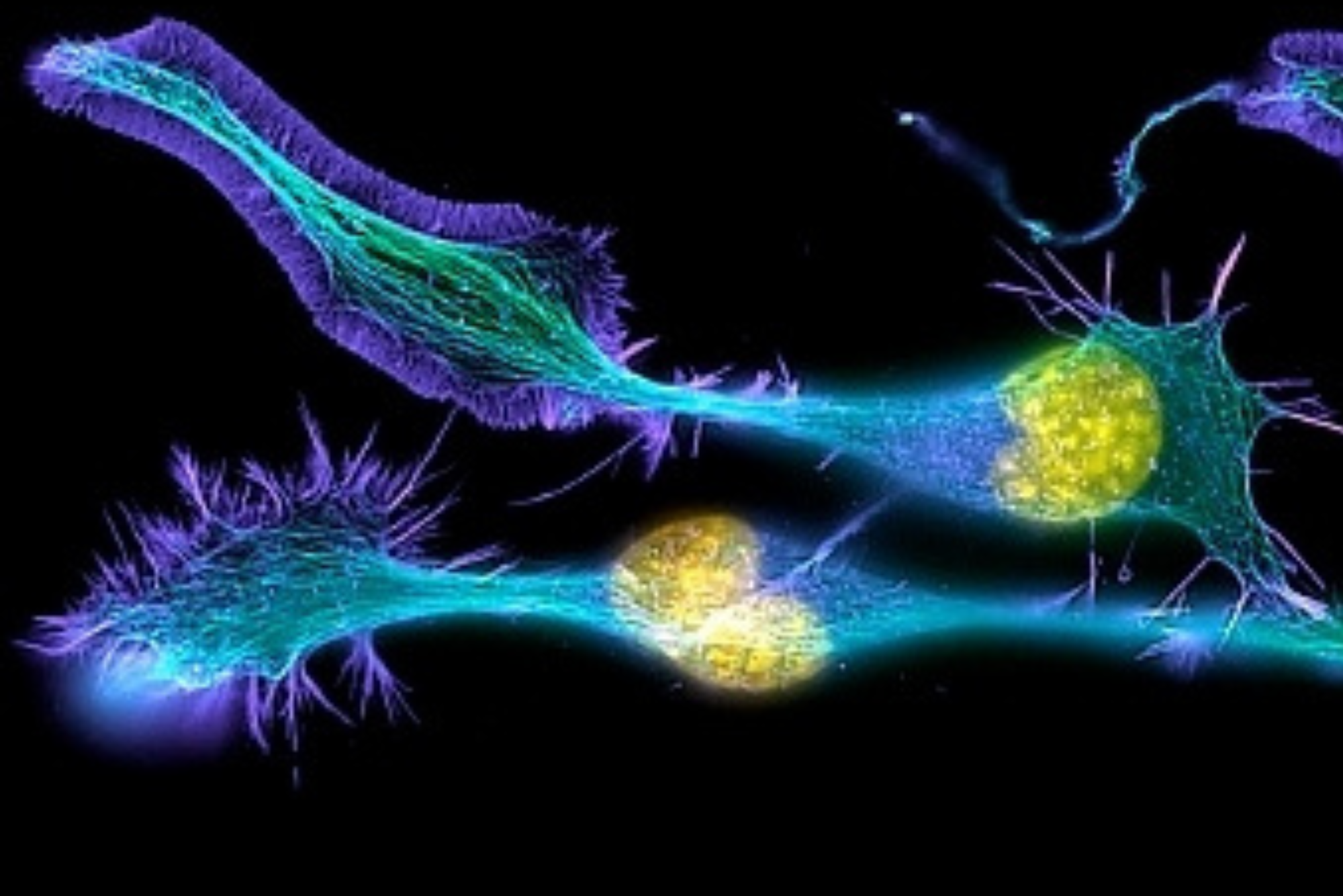 Как мозг думает? Интуиция, инсайт, предсказания, телепатия. Гид и фотограф в Валенсии Новиков Михаил