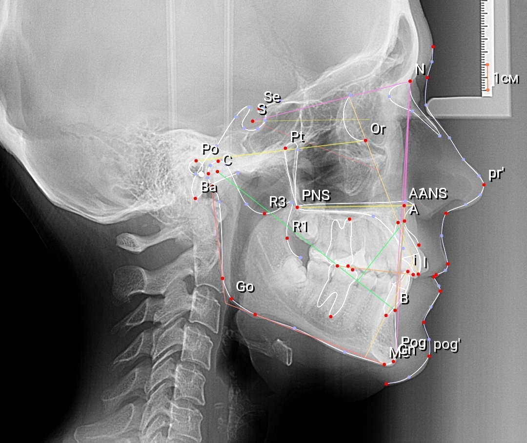 Стоимость диагностики. Стоматология «Ортодонт-Эстетик». Установка брекетов в Оренбурге, взрос