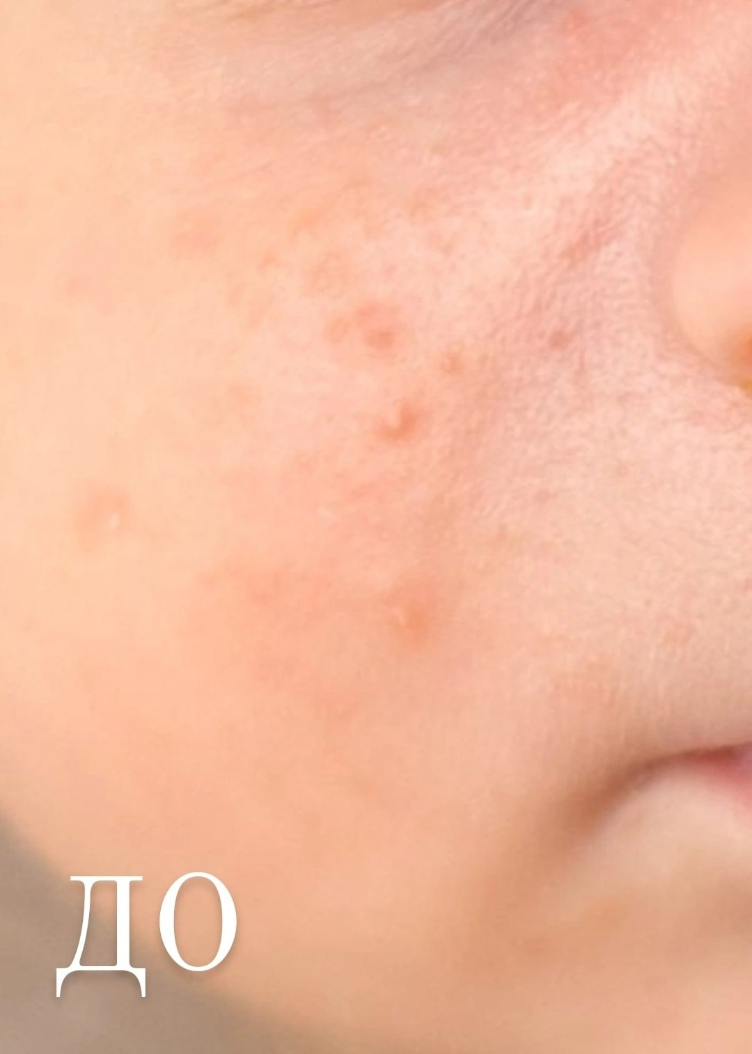 Фотосессия новорожденного с выздом на дом