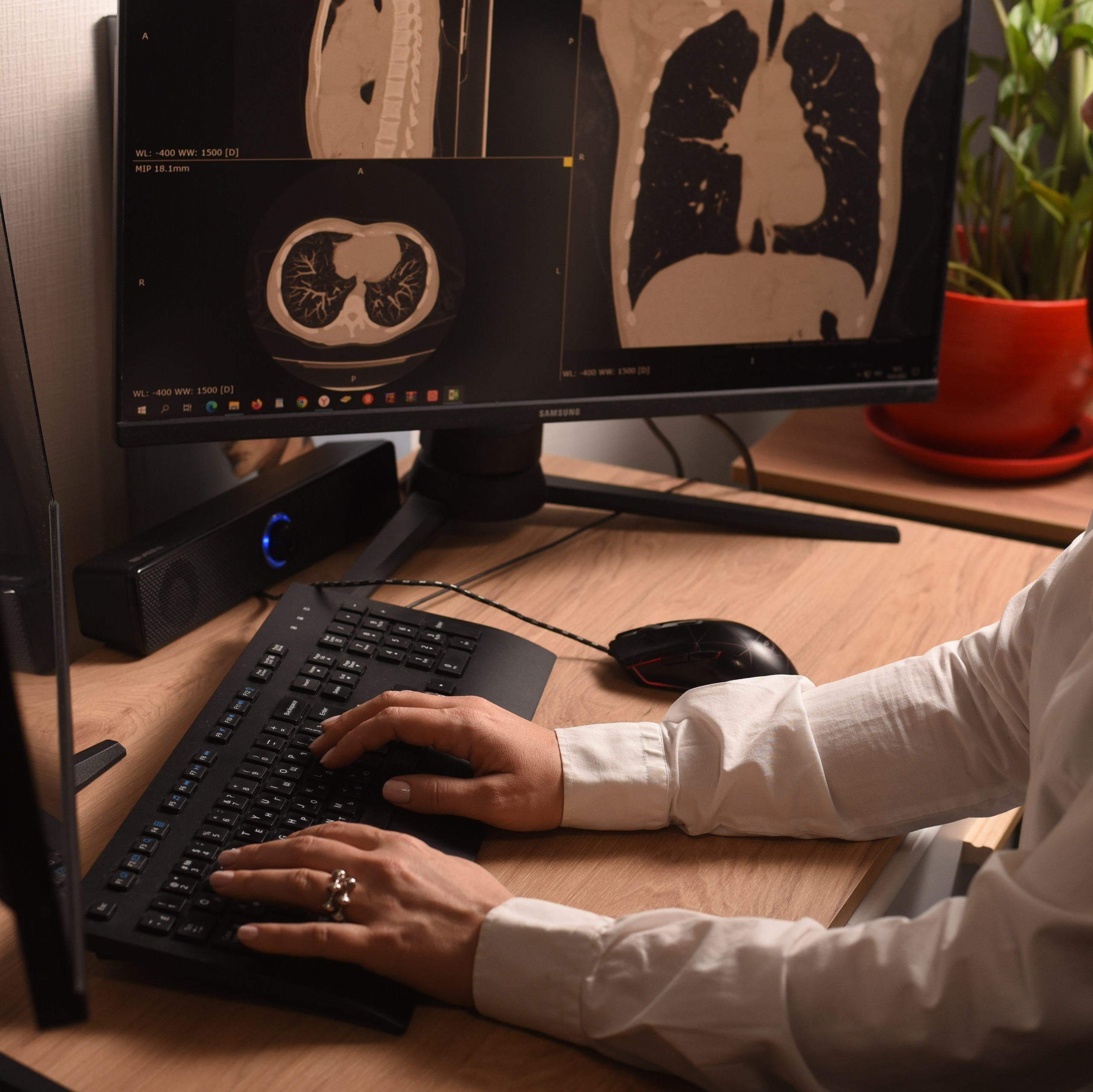 РЕНТГЕН КТ МРТ в Санкт-Петербурге Александра Лоншакова