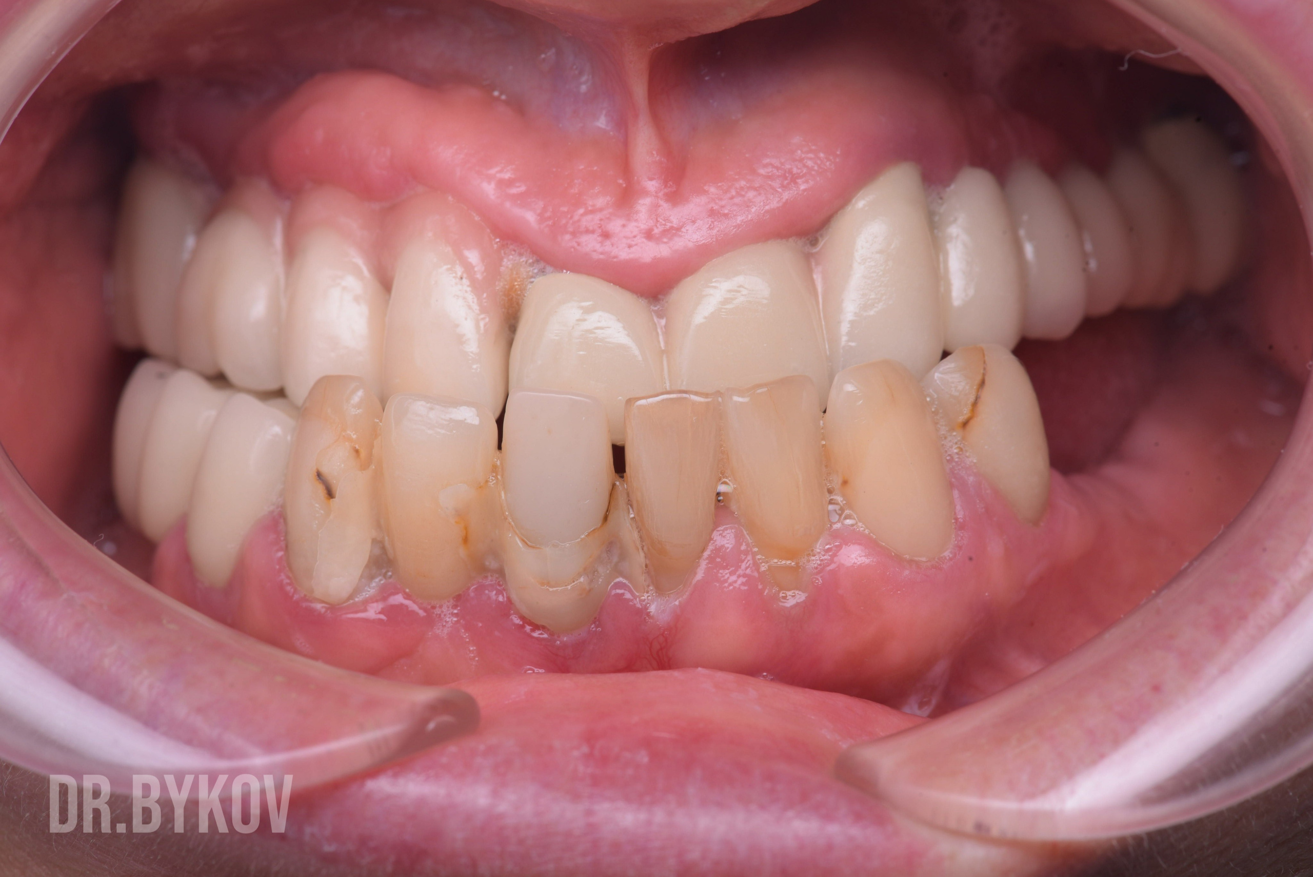 Портфолио. Врач стоматолог-ортопед Быков Алексей