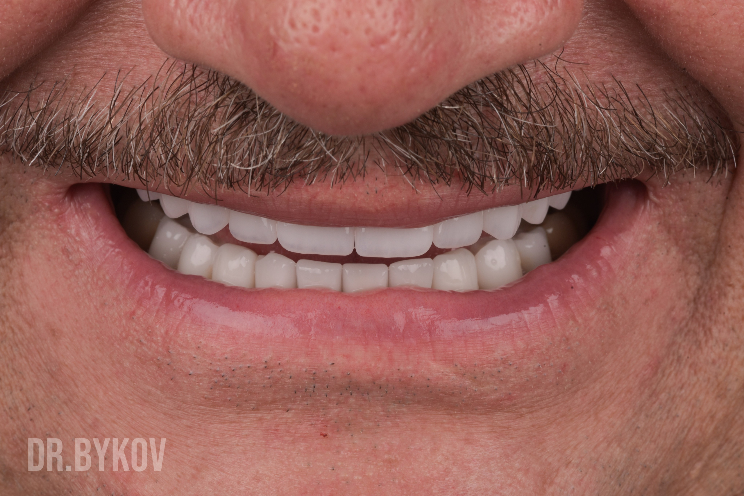 Портфолио. Врач стоматолог-ортопед Быков Алексей