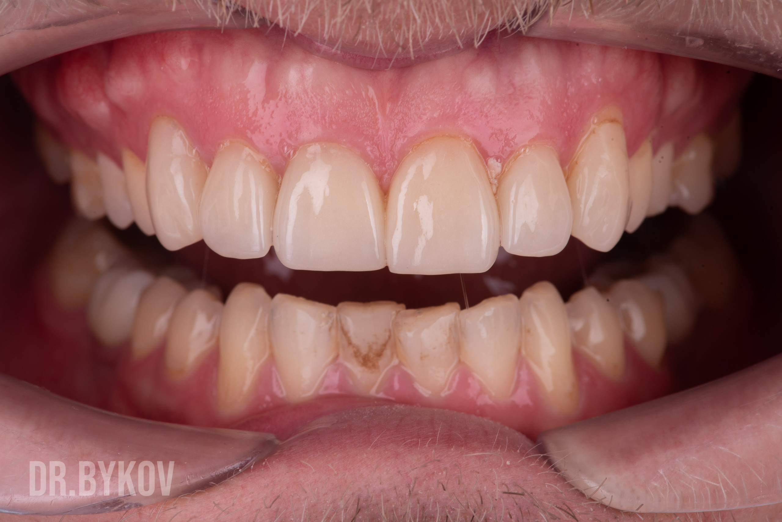 Портфолио. Врач стоматолог-ортопед Быков Алексей