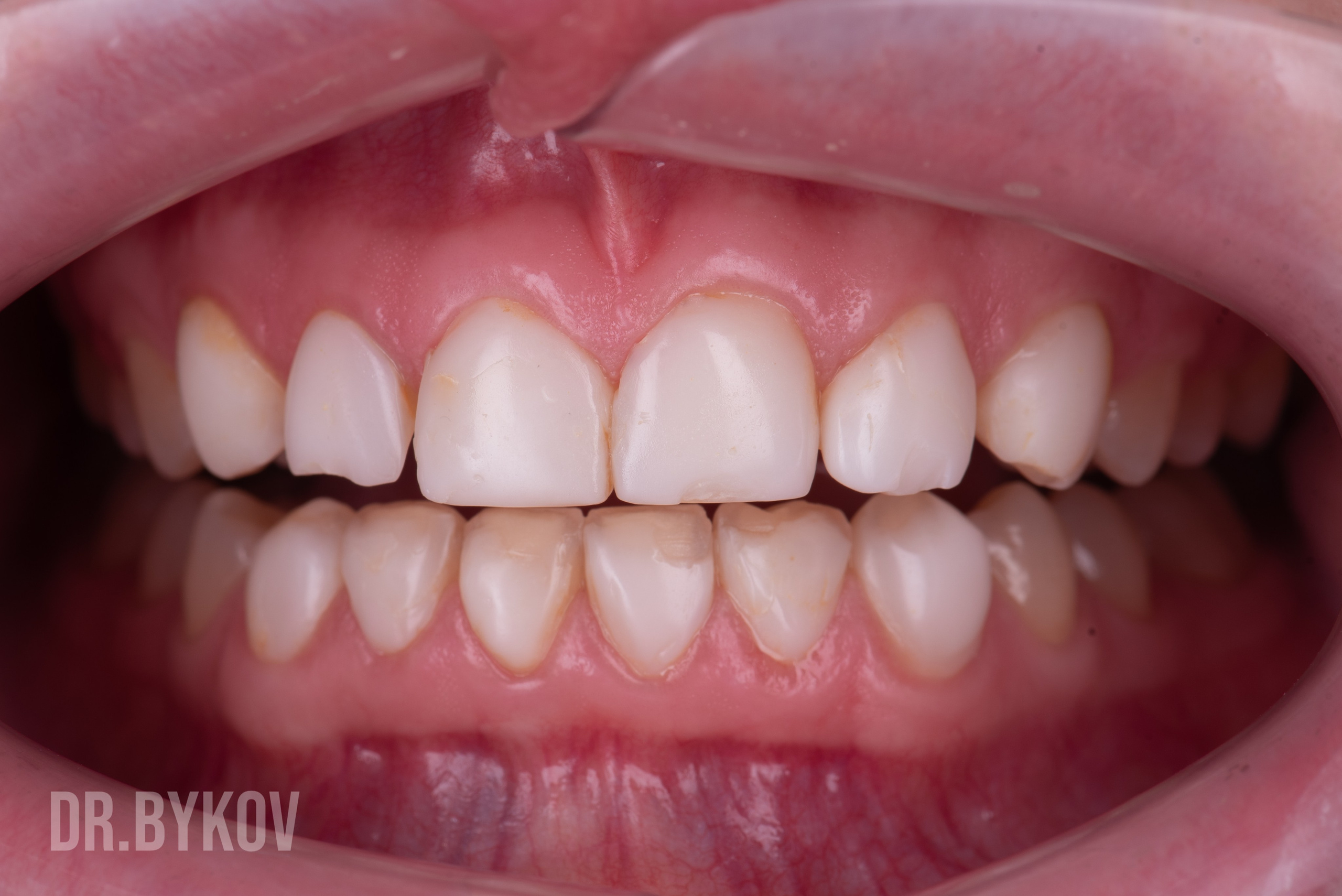 Портфолио. Врач стоматолог-ортопед Быков Алексей