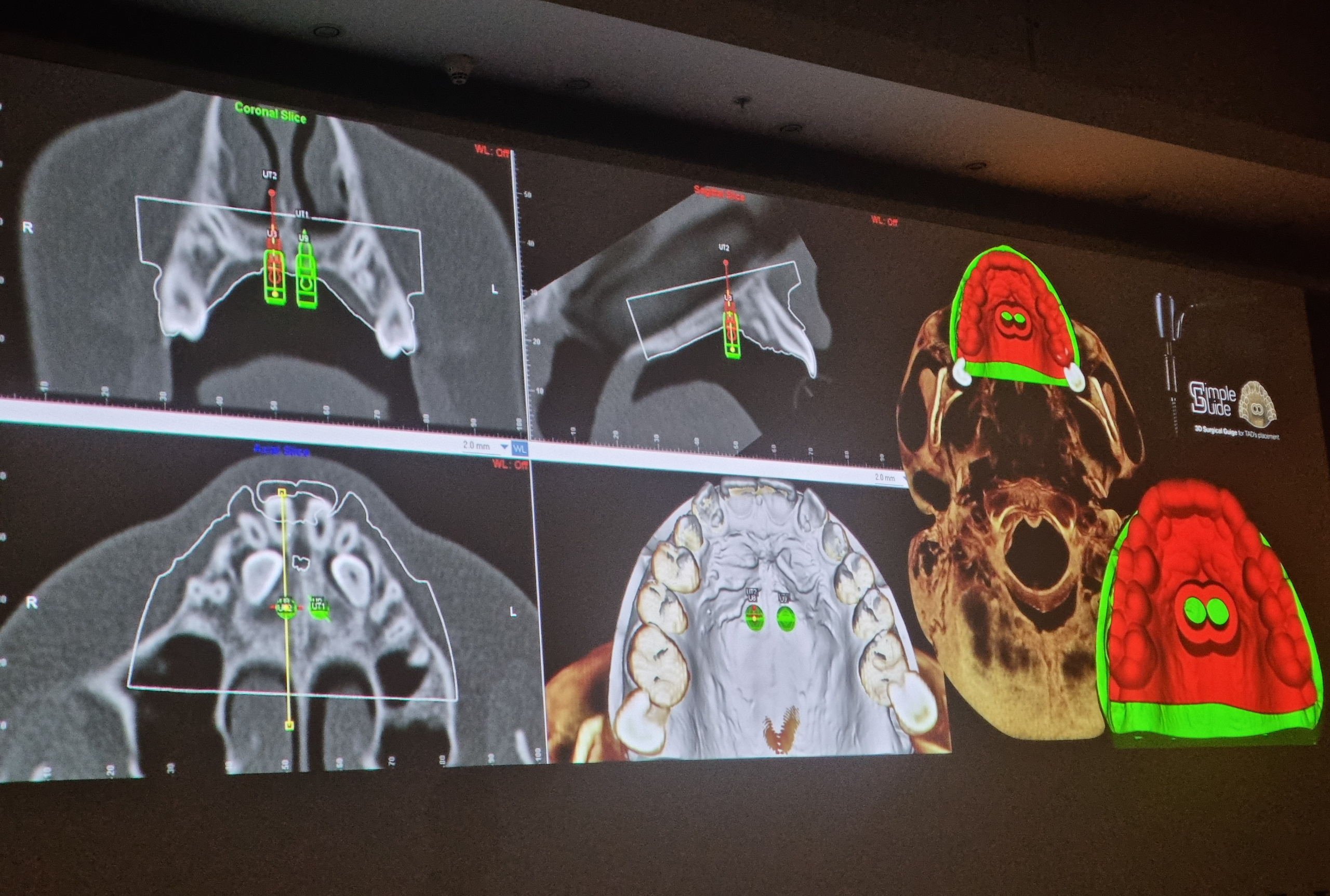 Стоматология в Твери - Линия Улыбки. Стоматология в Твери - Линия Улыбки