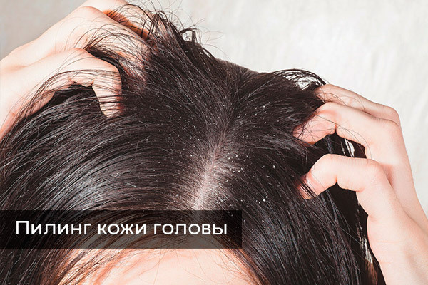 Пилинг кожи головы