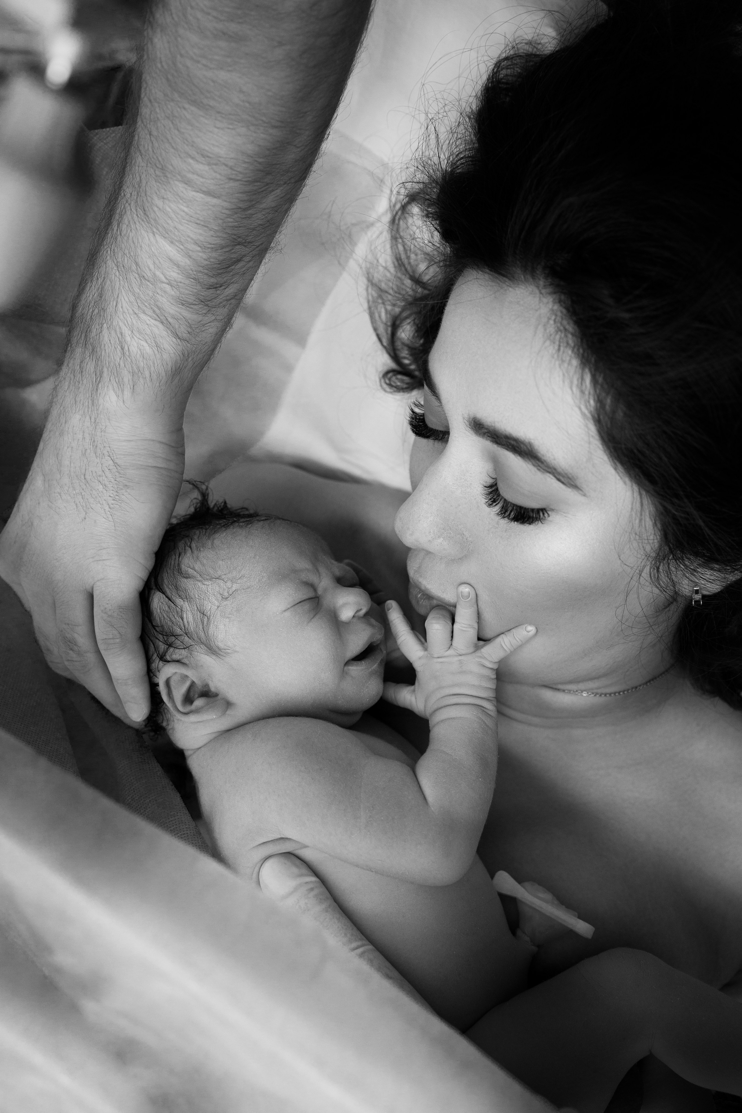 Айвазян на кесарево