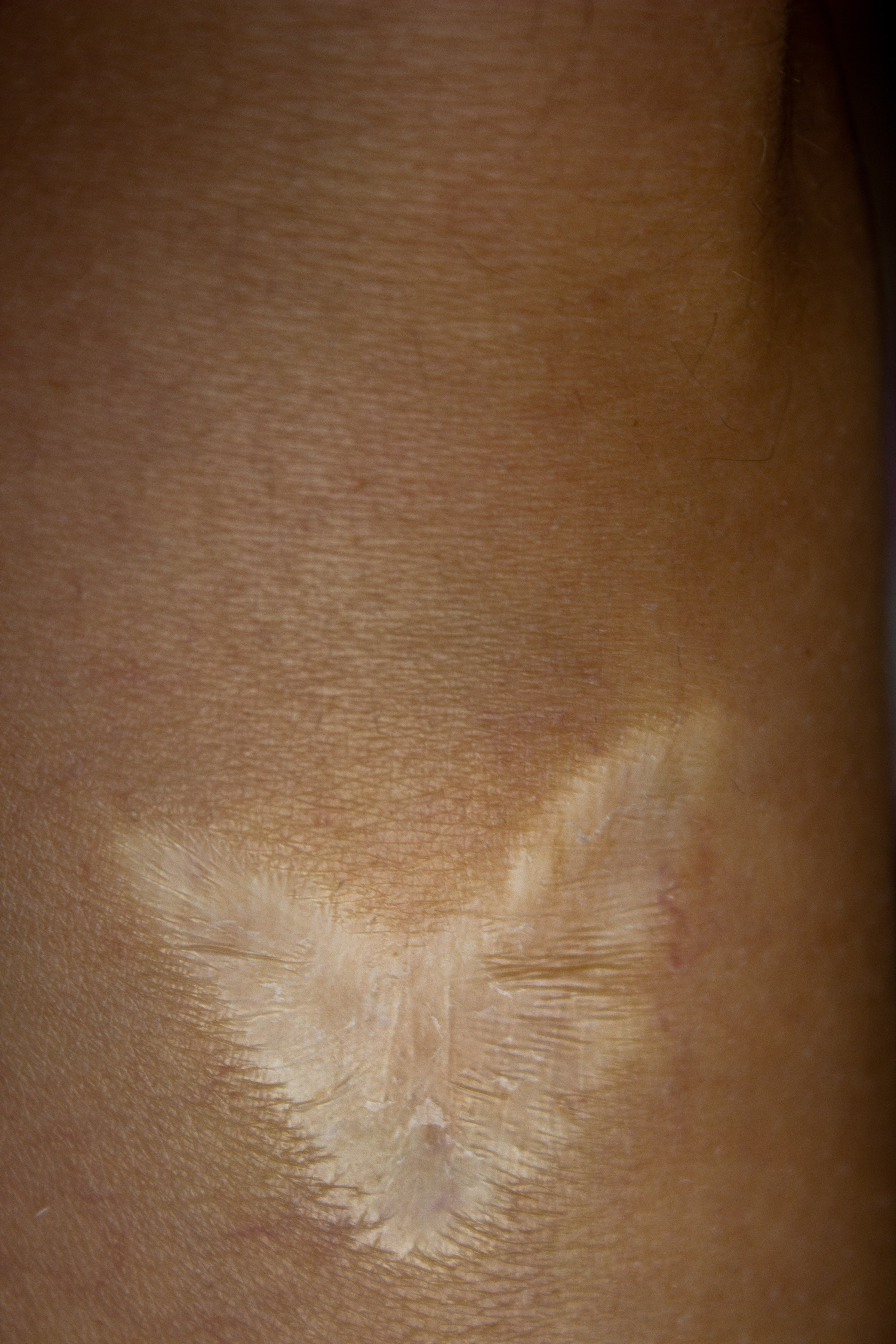 Анатомия трещин (красненькая биеннале, санкт-петербург, 2025). Julia Gorbunova