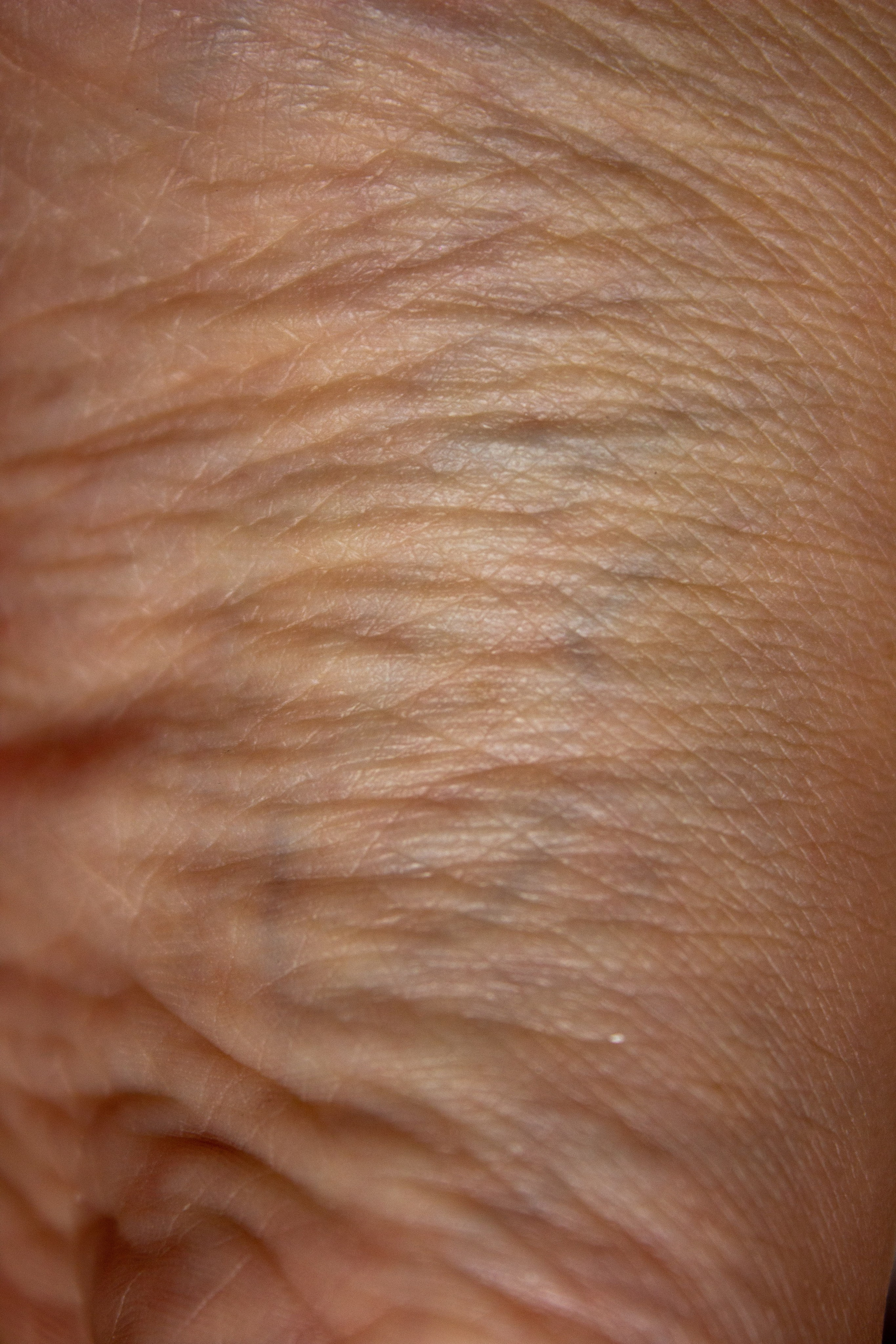 Анатомия трещин (красненькая биеннале, санкт-петербург, 2025). Julia Gorbunova