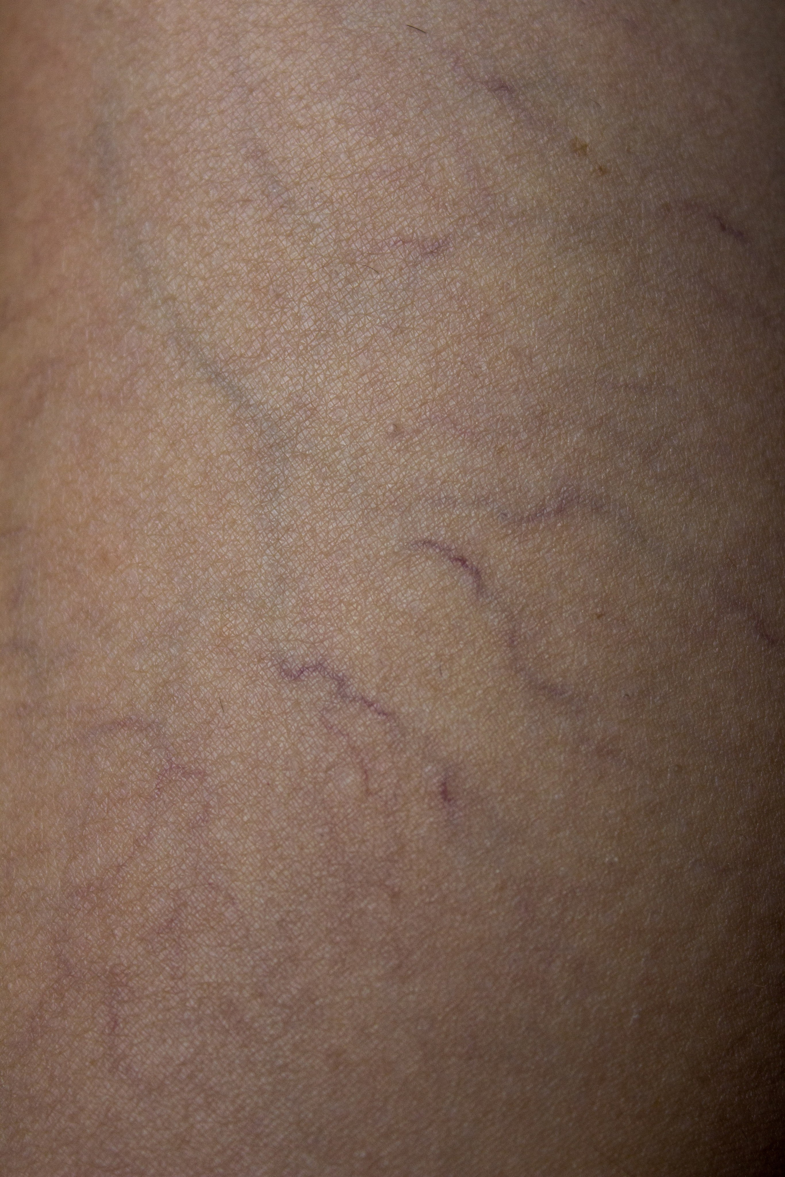 Анатомия трещин (красненькая биеннале, санкт-петербург, 2025). Julia Gorbunova