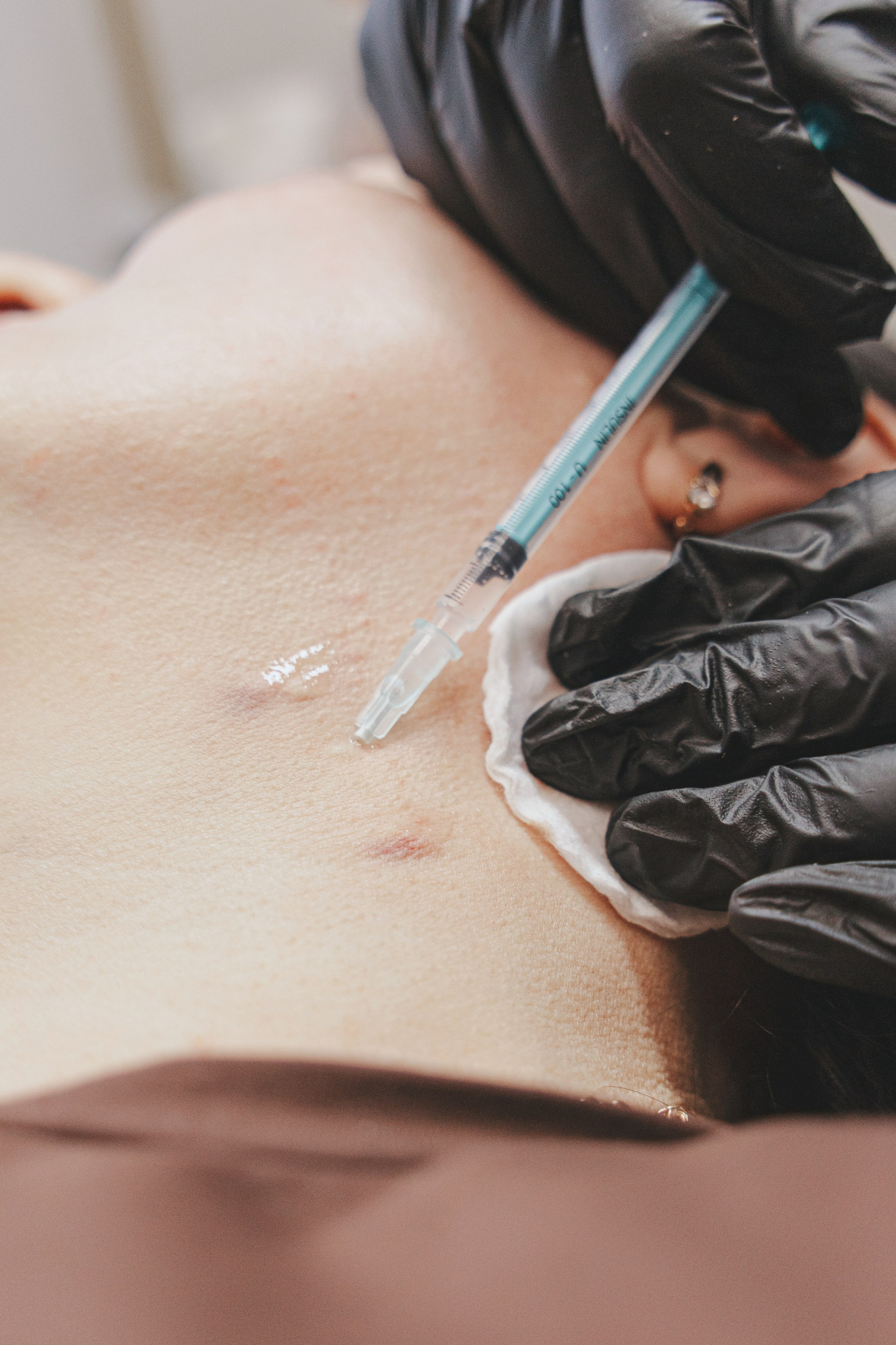 Контентная съемка косметолога — как показать инъекции и препараты естественно и продающе. Контентная съёмка в Курске | Юлия Болычева