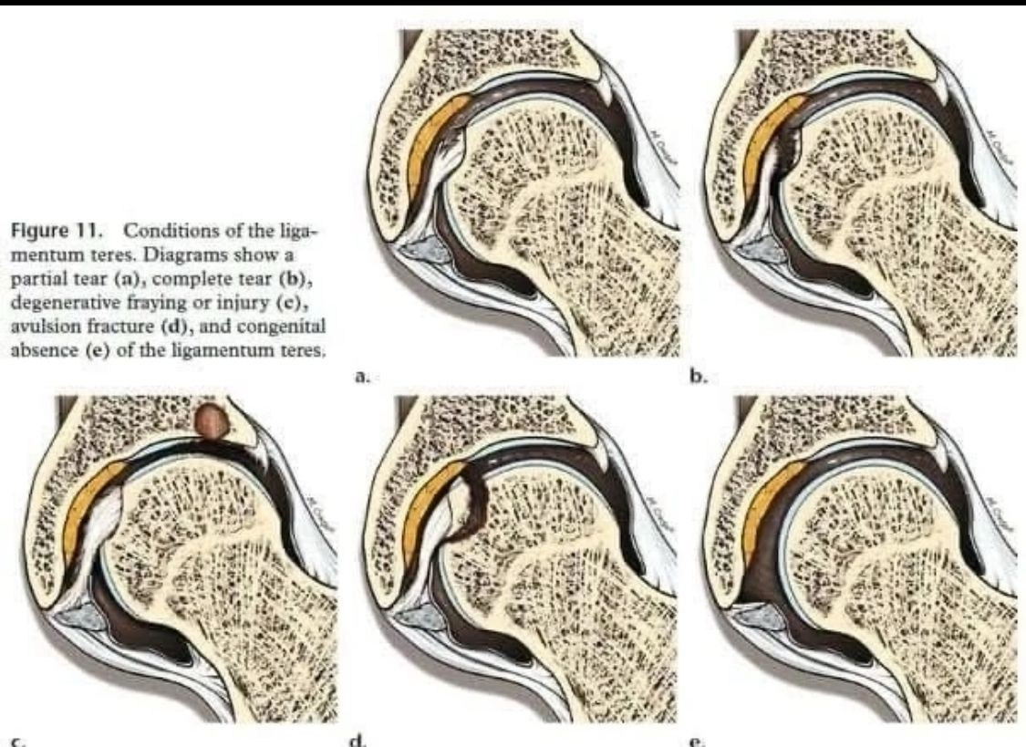 10 ФАКТОВ О ДИСПЛАЗИИ ТАЗОБЕДРЕННОГО СУСТАВА У СОБАК. ПИТОМНИК СОБАК ПОРОДЫ АМЕРИКАНСКИЙ БУЛЛИ