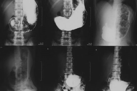 Для чего делать клизму перед рентгеном?. РЕНТГЕН КТ МРТ в Санкт-Петербурге Александра Лоншакова