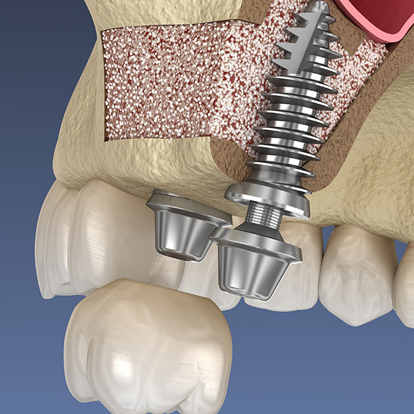Стоматолог хирург-имплантолог Иванов Андрей Анатольевич