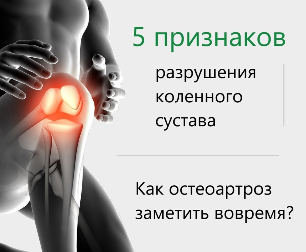 Артроз коленного сустава чем лечить