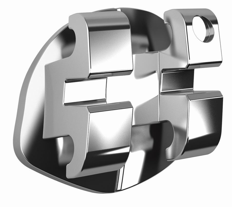 Обычные классические брекеты. Стоматология «Ортодонт-Эстетик». Установка брекетов в Оренбурге, взрос